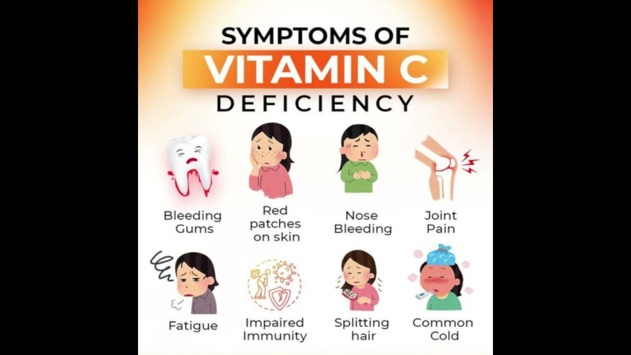 Symptoms of Vitamin C Deficiency 