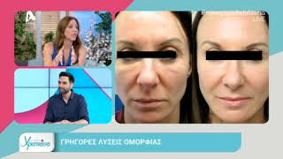 Ο Δρ. Ελευθέριος Γιαννακος στο ALPHA TV Cyprus, 