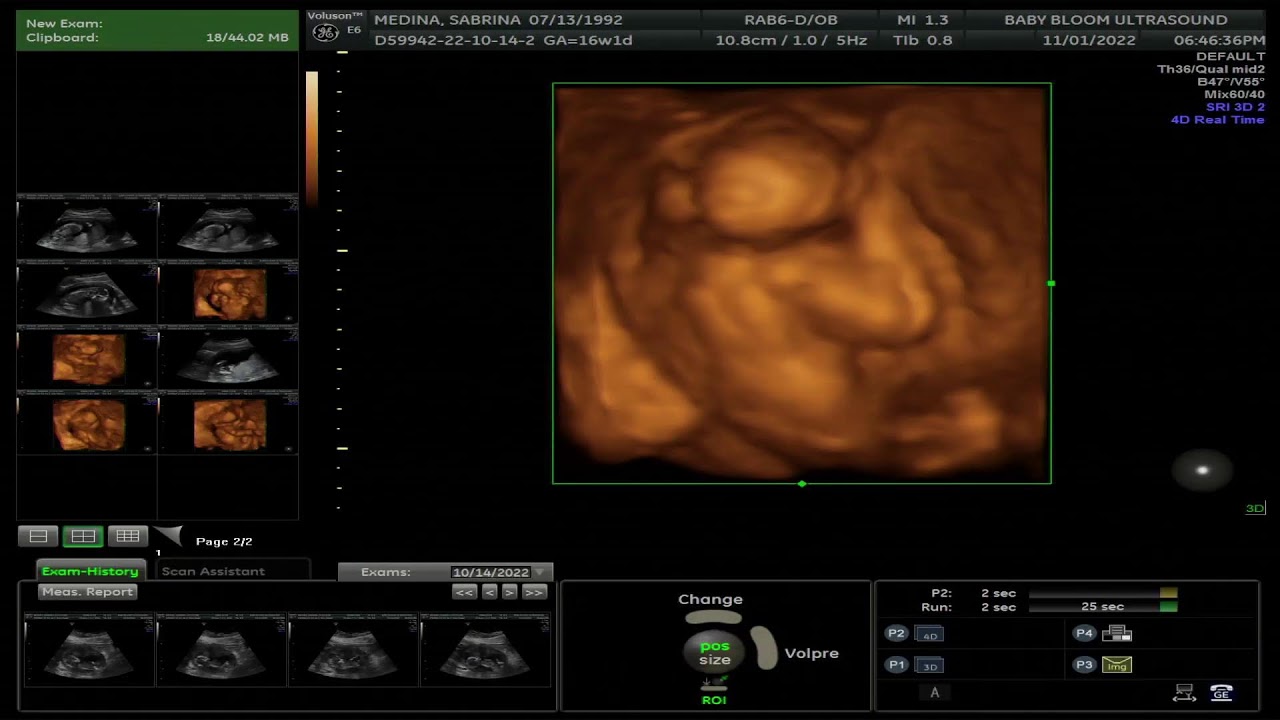 Baby Bloom Ultrasound Studio