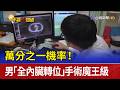 萬分之一機率！ 男「全內臟轉位」手術魔王級