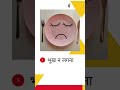अपेंडिक्स के लक्षण: इन्हें पहचानें और समय पर इलाज पाएं | माँ एण्ड फैमिली मल्टीस्पेशलिटी हॉस्पिटल