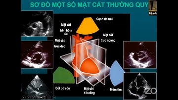 #03 Siêu âm Doppler tim trong cấp cứu. Bác sĩ Nguyễn Tuấn Hải