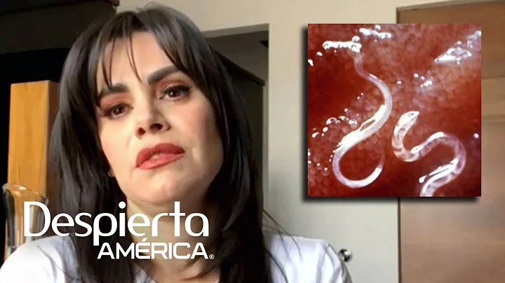 "Tienes larvas en el rostro": Luz Elena Gonzlez re...