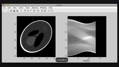 Radon Transform Of The Shepp Logan Phantom