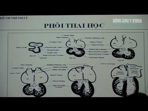 Video Kênh nhĩ thất, PGS TS Phạm Nguyễn Vinh - youtube