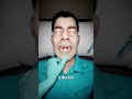 Pov : If your Uvula are Long | Advice What ?? happens #viral #trending #viralvideo