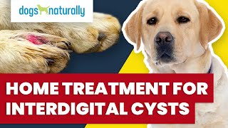 Home Treatment For Interdigital Cysts