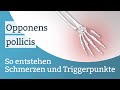 Opponens pollicis schmerzen triggerpunkte und deren aktivierung