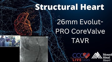 26mm Evolut-PRO CoreValve TAVR - March 13, 2018