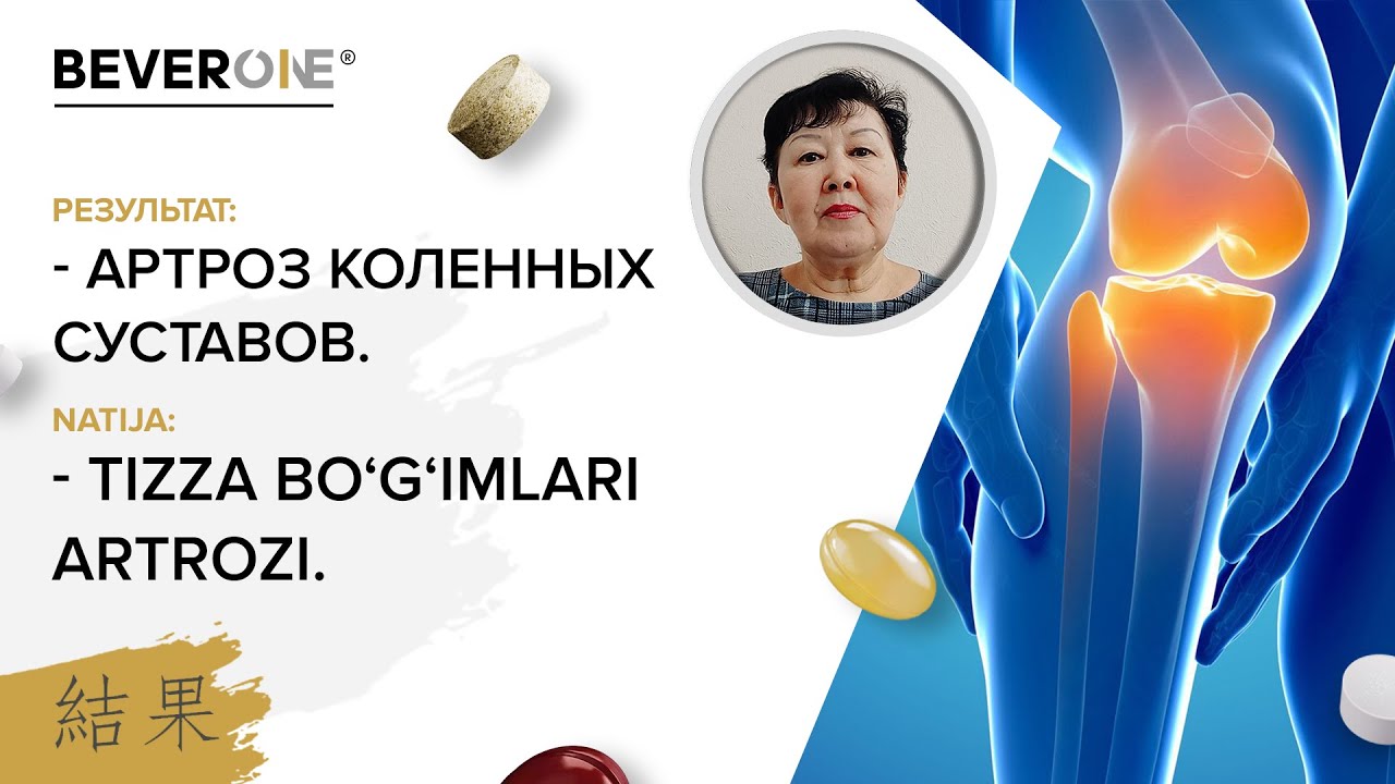 Артроз коленных суставов - Результат | BEVERONE - YouTube