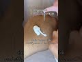 #shortvideo #skincare