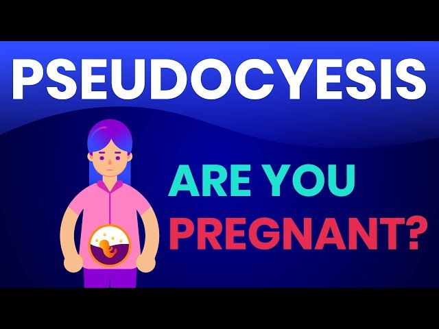 phantom pregnancy (Pseudocyesis & Couvade Syndrome) 