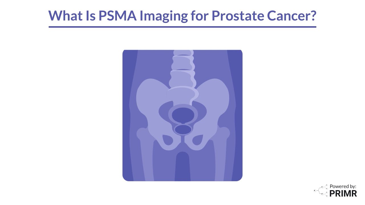 Что такое ПСМА-визуализация?