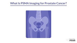 What is PSMA Imaging?