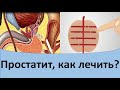 Простатит как лечить? Простатит лечение.