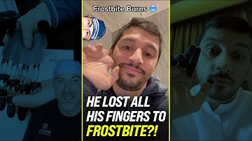 Unreal, He Lost All His Fingers to Frostbite?! 🥶 #shorts
