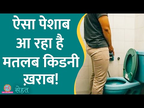 वीडियो: क्या पेशाब में कीटोन खराब होता है?