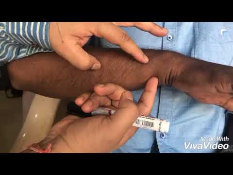 LOWER arm part 1 (33unit) master Tung Acupuncture, PILESS , FISTULA , HAEMORRHOID , LEUCORRHOEA