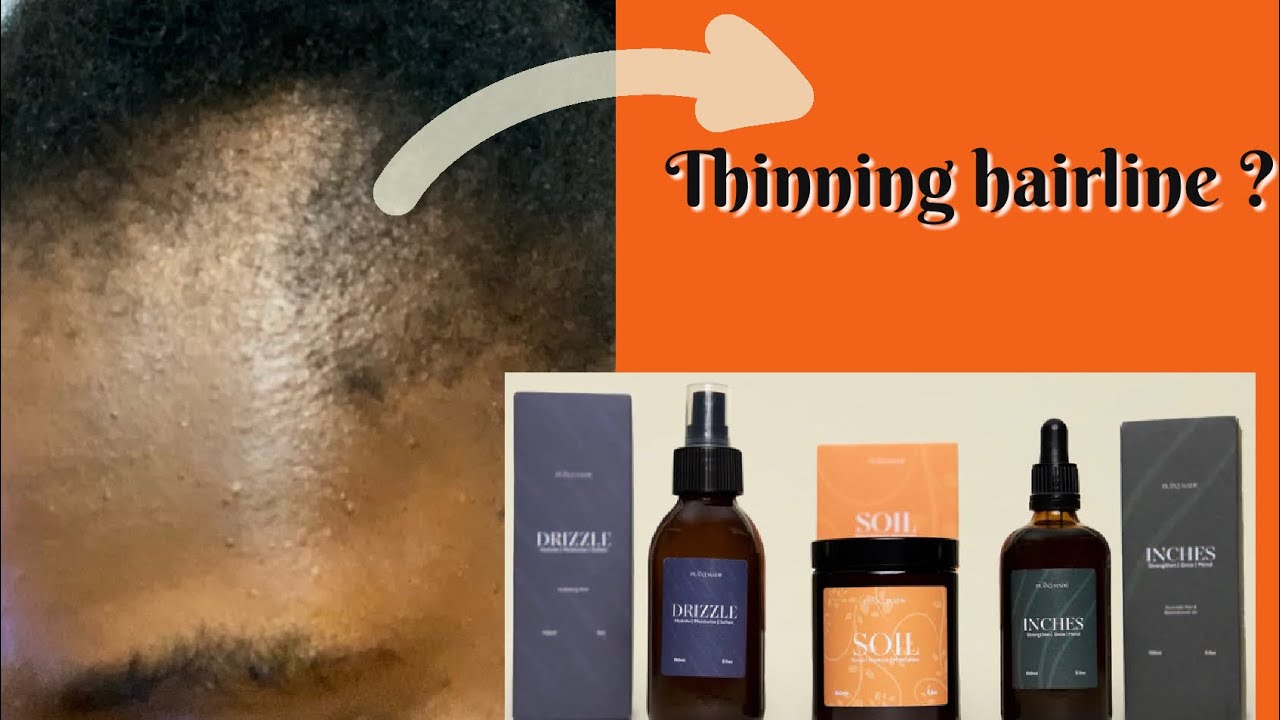 PLANTMADE HAIR PRODUCTS REVIEW 2023 How to regrow BALD SPOTSPlantmade