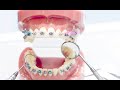 Orthodontics; dental specialty for diagnosing, preventing, correcting misaligned teeth, jaws