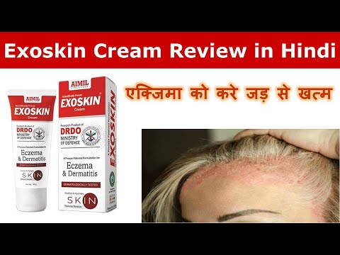 Aimil Exoskin Cream Review In Hindi