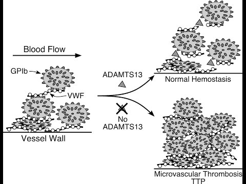 Thrombotic Thrombocytopenic Purpura (TTP)