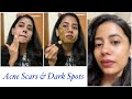 Remove Acne Scars, Dark Spots and Discoloration Naturally with this Routine