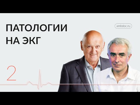 «В ритме сердца»: перелистаем страницы первой части практикума по ЭКГ. 28.02.24.
