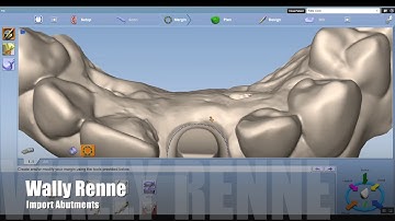 import Atlantis Custom Abutment into Romexis
