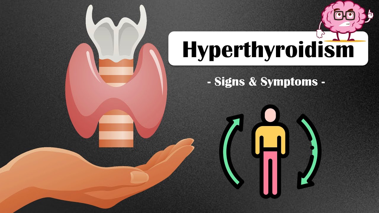 Signs Symptoms Of Hyperthyroidism What Are The Major Signs signs-symptoms-of-hyperthyroidism-what-are-the-major-signs