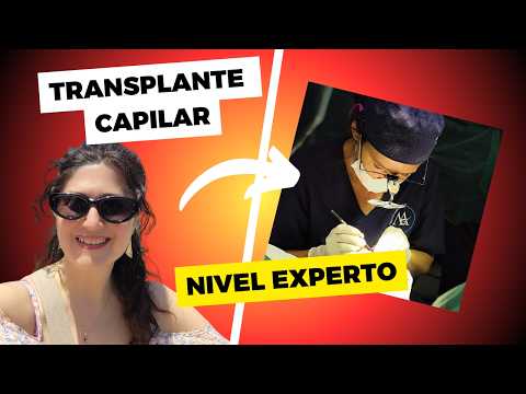 TRANSPLANTE CAPILAR y viaje al curso de ESPECIALIZACIÓN en TRICOLOGÍA Málaga,España Dra. Gloria Abad