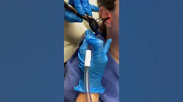 Ear Wax Removal Using Suction By An ENT 