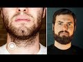 What I Wish I Knew Before Growing a Beard