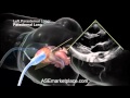 How to do a Basic Transthoracic Echocardiogram: Transducer Position and Anatomy