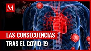 Pacientes que tuvieron covid hace dos años presentan problemas de pulmón y corazón Resimi