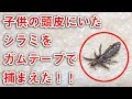 頭皮にいたアタマジラミをガムテープで捕まえた!! | Discovery of louse