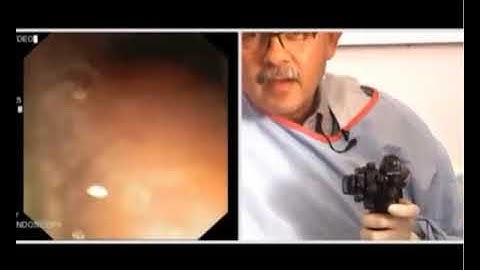 Duodenoscopy. How I do It. Dr Amit Maydeo