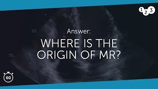 60 Seconds Of Echo Teaching Answer Where Is The Origin Of Mr?