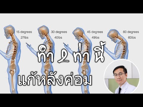 ทำ 2 ท่า นี้ แก้หลังค่อม
