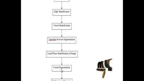 Automated Vessel Segmentation-Infinite Perimeter Active Contour -Hybrid Information-Retinal Images