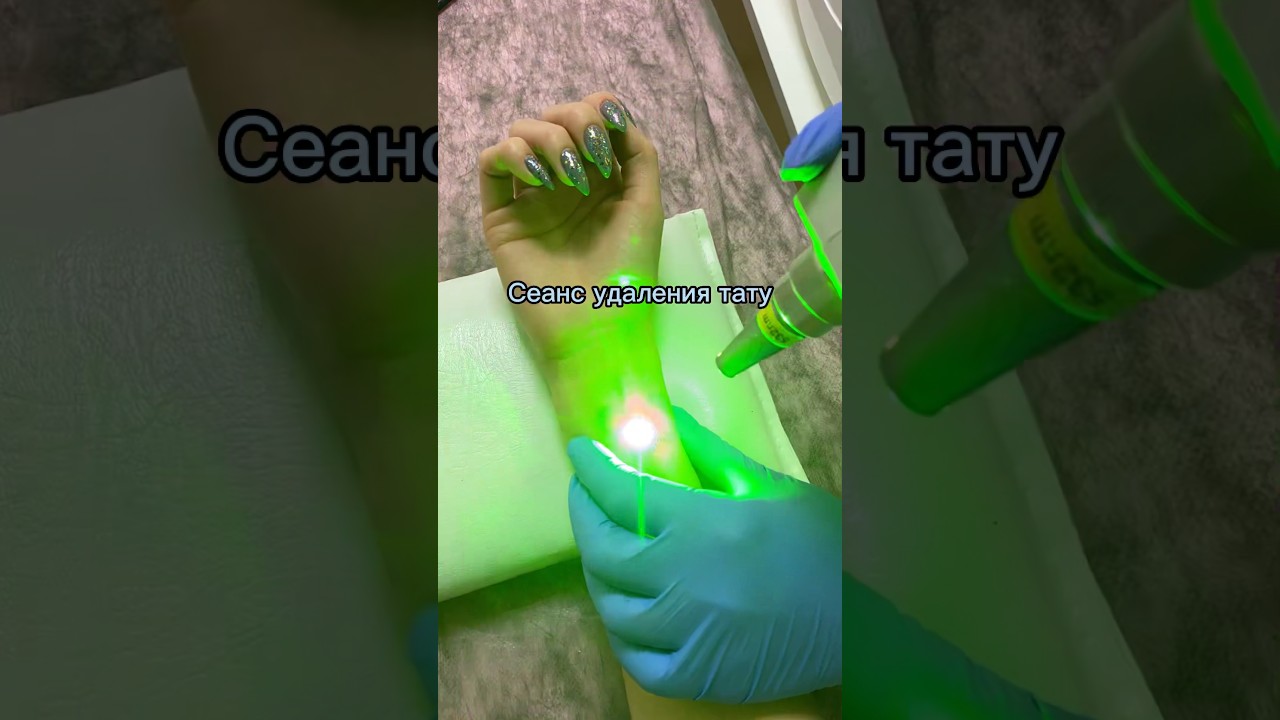 НИКОГДА НЕ СНИМАЙТЕ ПРОЦЕСС УДАЛЕНИЯ ЛАЗЕРОМ! Это убьёт вашу камеру ...