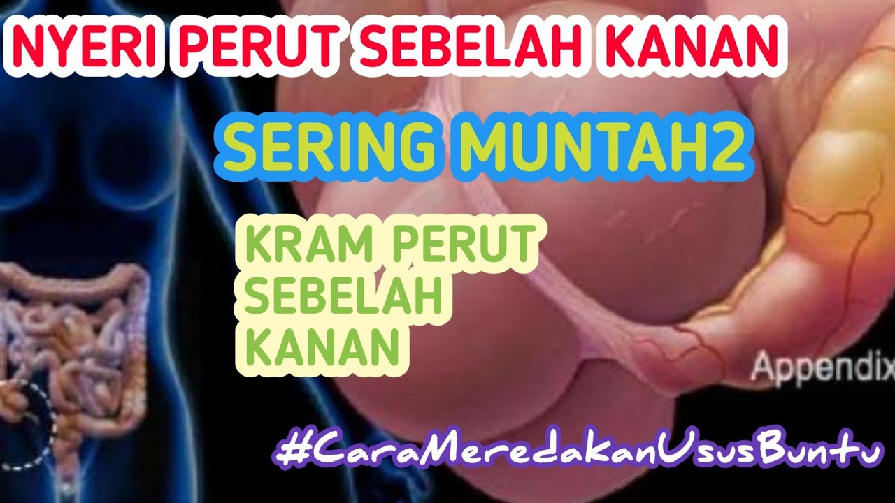 Cara Mengatasi Gejala Usus Buntu