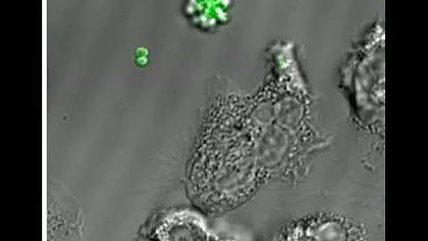 Phagocytosis of MRSA by a human neutrophil