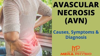 Avascular Necrosis (AVN) | Introduction, Causes, Symptom & Diagnosis | In Hindi | Mera Physio
