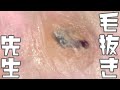 018 【200x Zoom】Shake is improved with more recent videos Dr. tweezers Remove hair microscope 毛抜先生