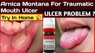 Homeopathic Medicine For Mouth Ulcer| Arnica Montana | Mouth Ulcers | @Dr. Aniruddha De ||