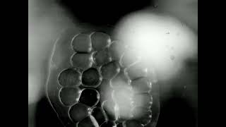 Ramshorn Snails egg to hatching timelapse