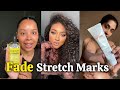 Women Are Clearing Their Stretch Marks With These Powerful Hacks 😳