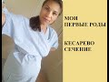 Мои первые роды за 20 минут. Кесарево сечение. Роддом в Химках.