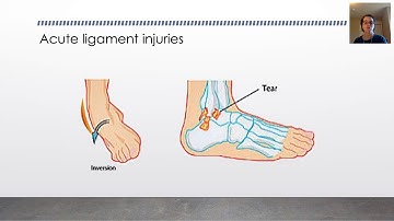 Biomechanics: Tendon & Ligament Injury